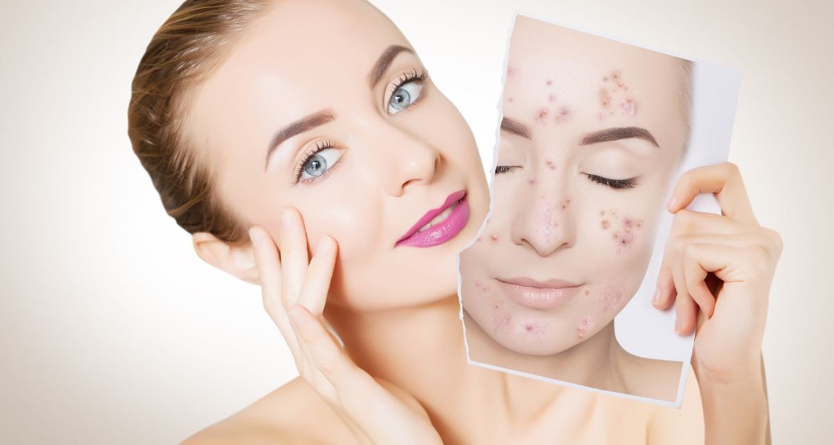 Como Escolher o Sabonete Facial Ideal para a Sua pele